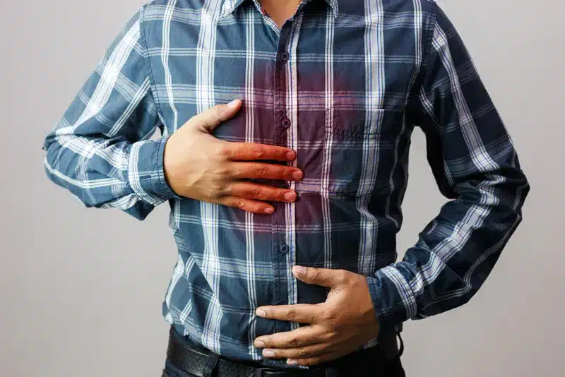 Acid Reflux