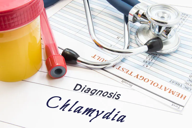 Azithromycin