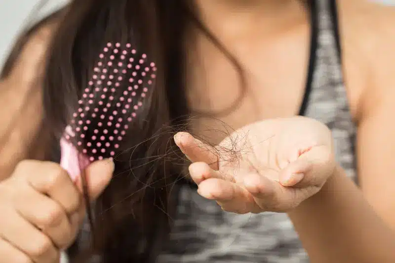 Hair Loss