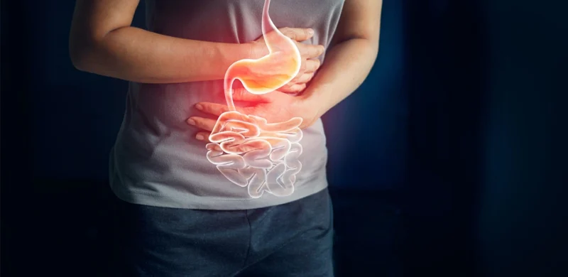 Crohn Disease