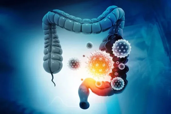 colon cancer