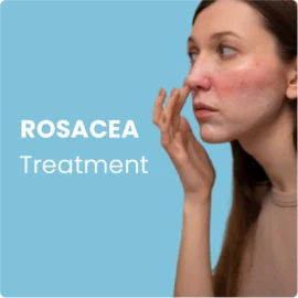Rosacea Treatment