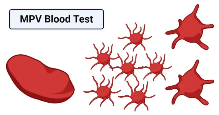 MPV Blood Test